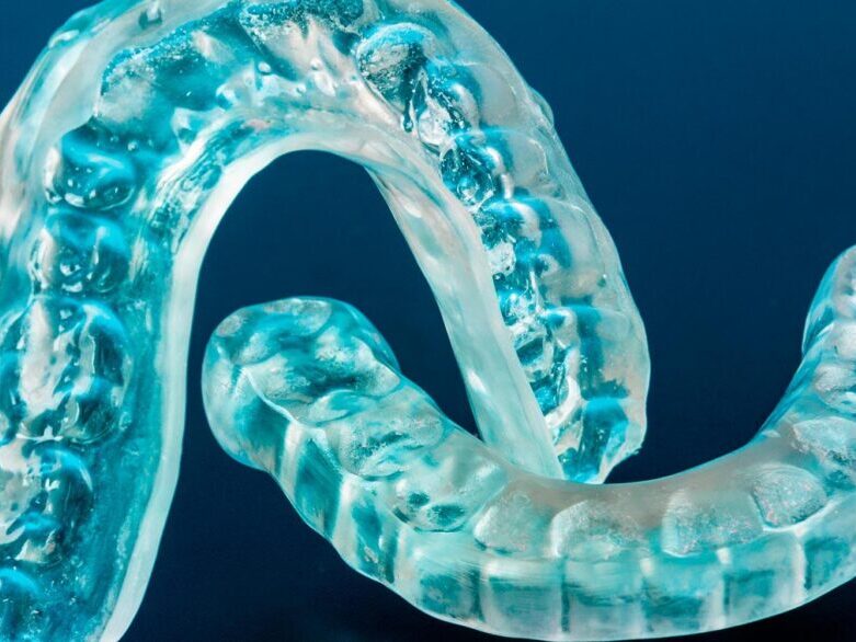 treatments-dentalguards