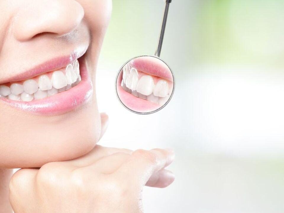 Teeth Whitening