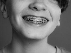 Braces