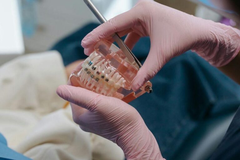 How Do Orthodontists Adjust Dental Braces Over Time