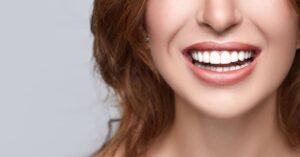 Braces 