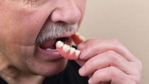 Dentures