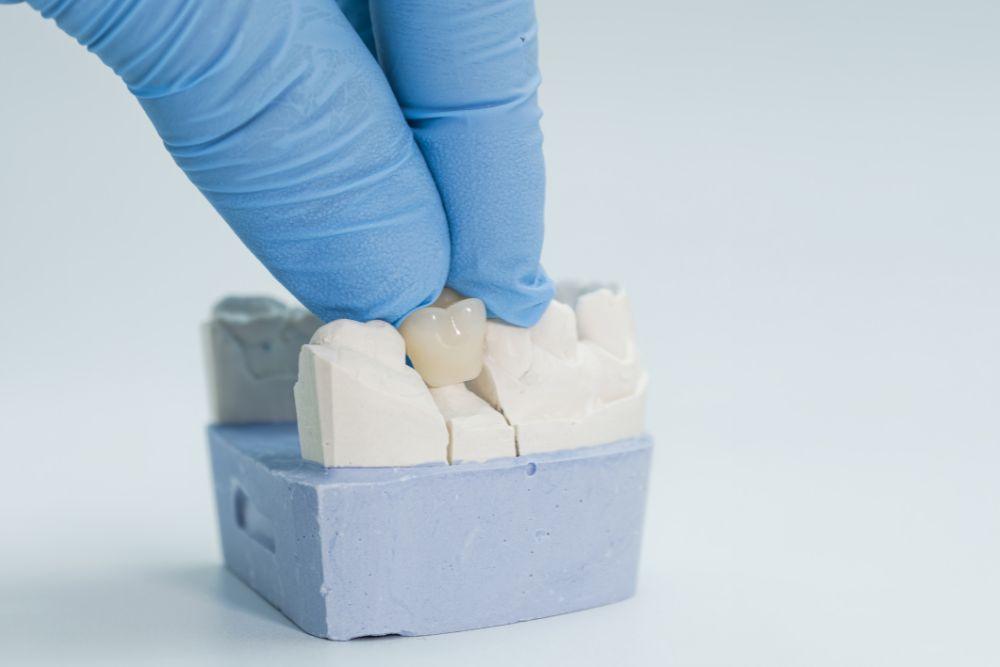 Dental Crown