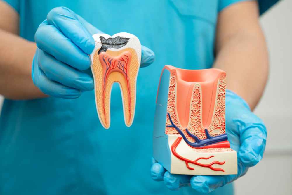 Root Canal Treatment